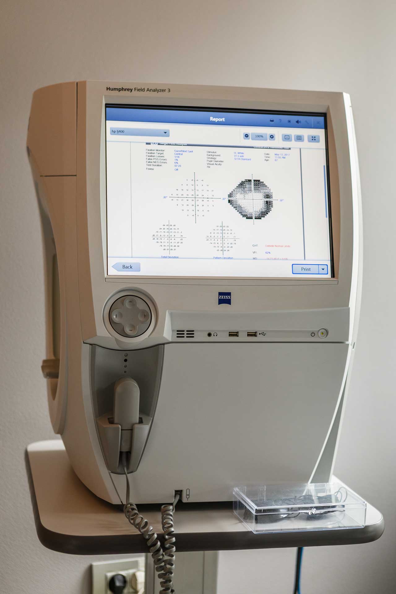 biomicroscopie endotelială oftalmologică